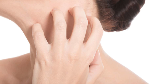 Natural Tips to Treat Skin Rashes